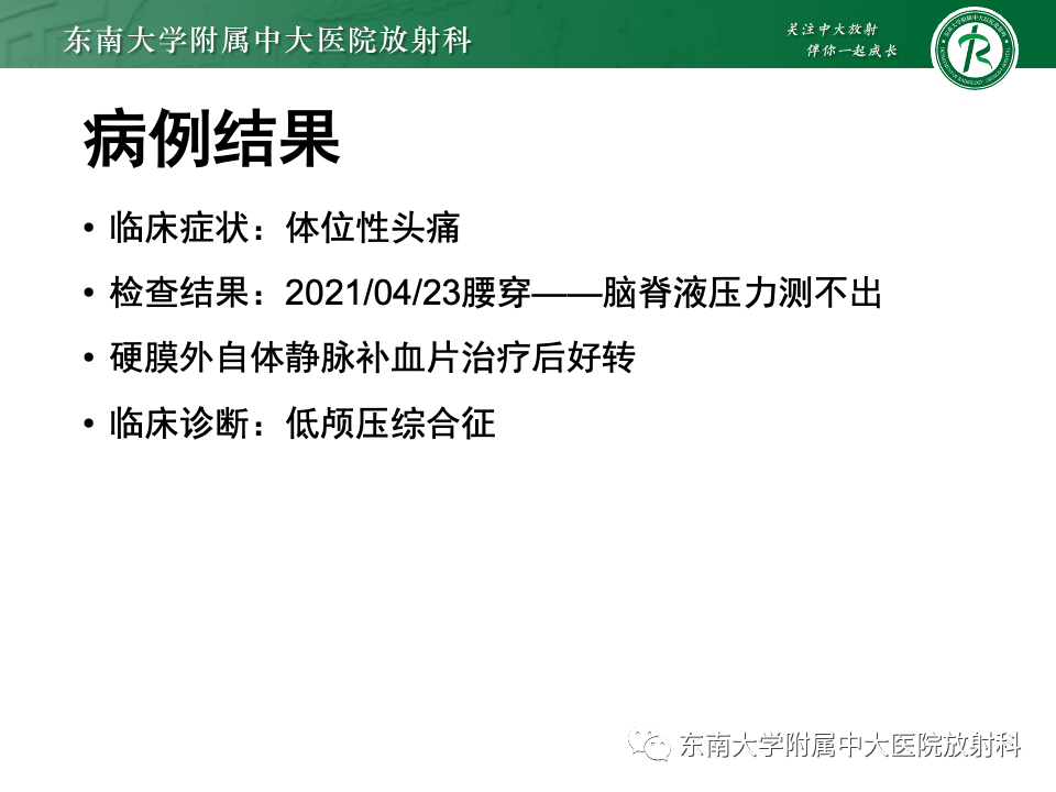 影像PPT - 【PPT】低颅压综合征的MRI表现-27 影像PPT - 【PPT】低颅压综合征的MRI表现-27