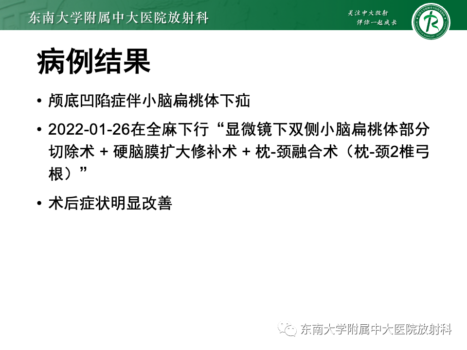 影像PPT - 【PPT】低颅压综合征的MRI表现-37 影像PPT - 【PPT】低颅压综合征的MRI表现-37