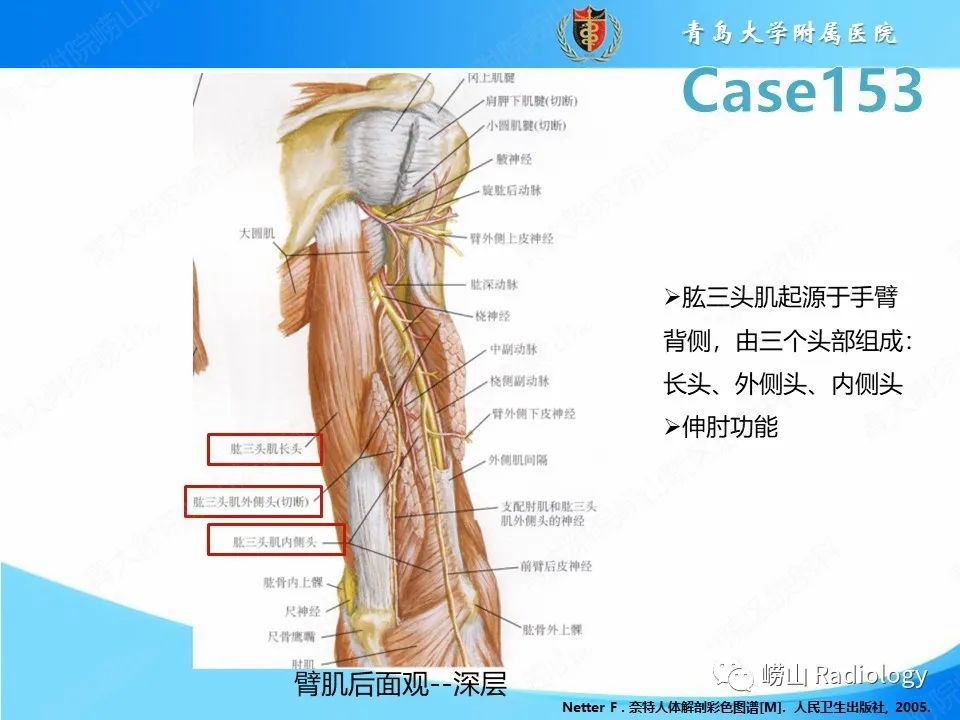 影像PPT - 【PPT】肱三头肌肌腱撕裂-11