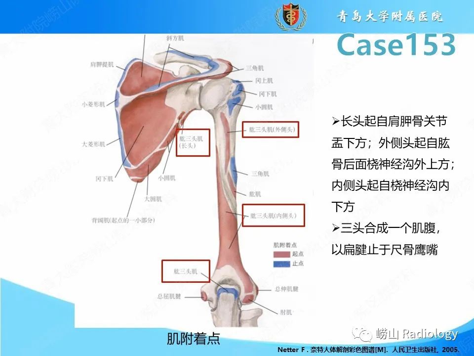 影像PPT - 【PPT】肱三头肌肌腱撕裂-12