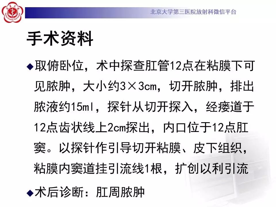影像PPT - 【PPT】肛周脓肿-8