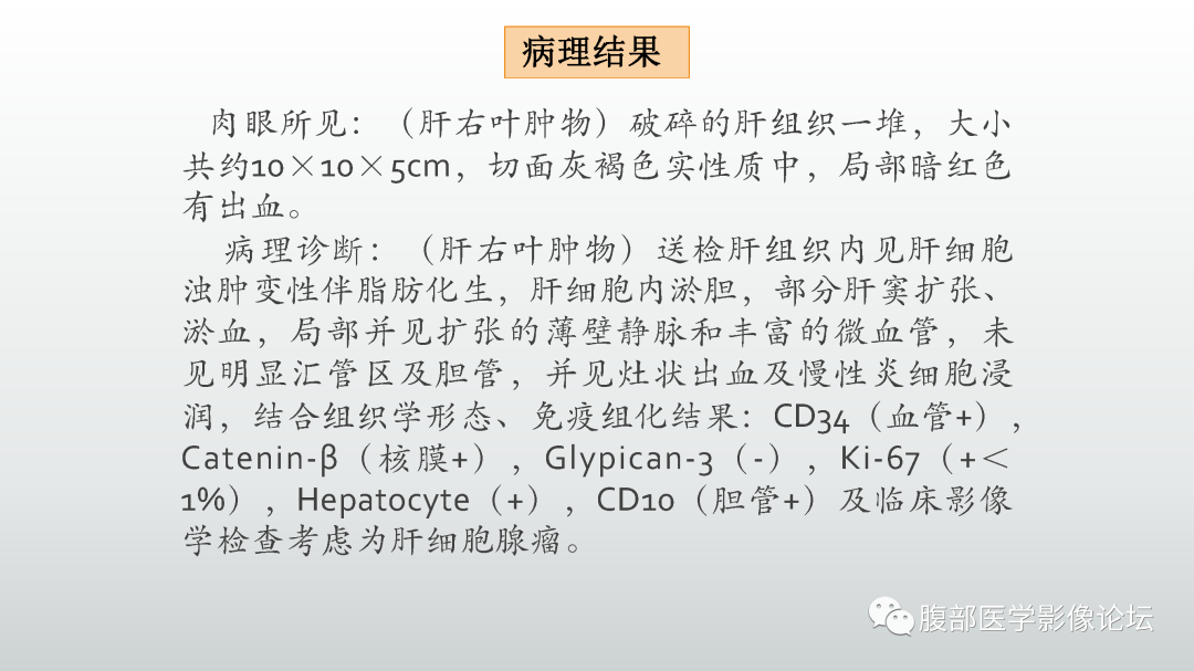 影像PPT - 【PPT】肝细胞腺瘤-9