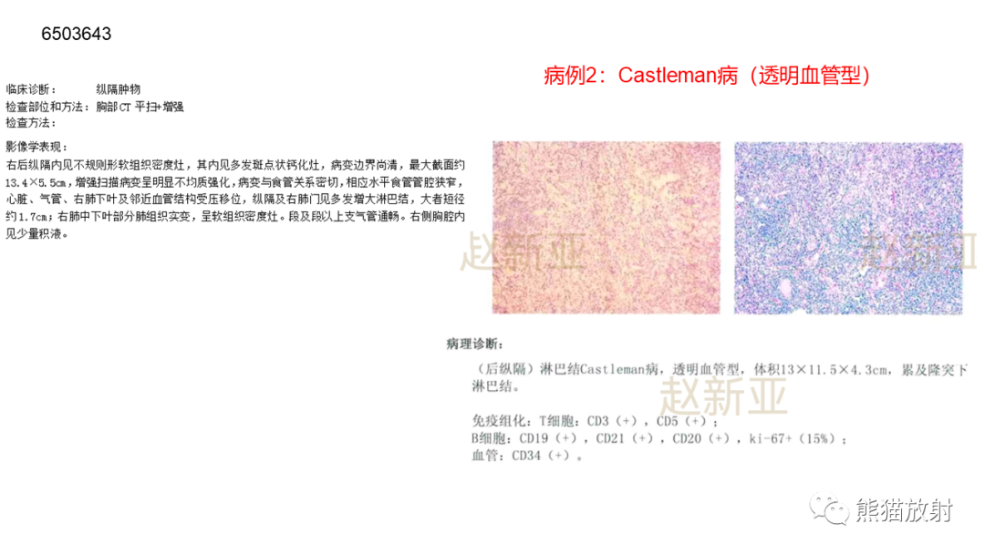 影像PPT - 【病例】纵隔Castleman病2例CT影像-18