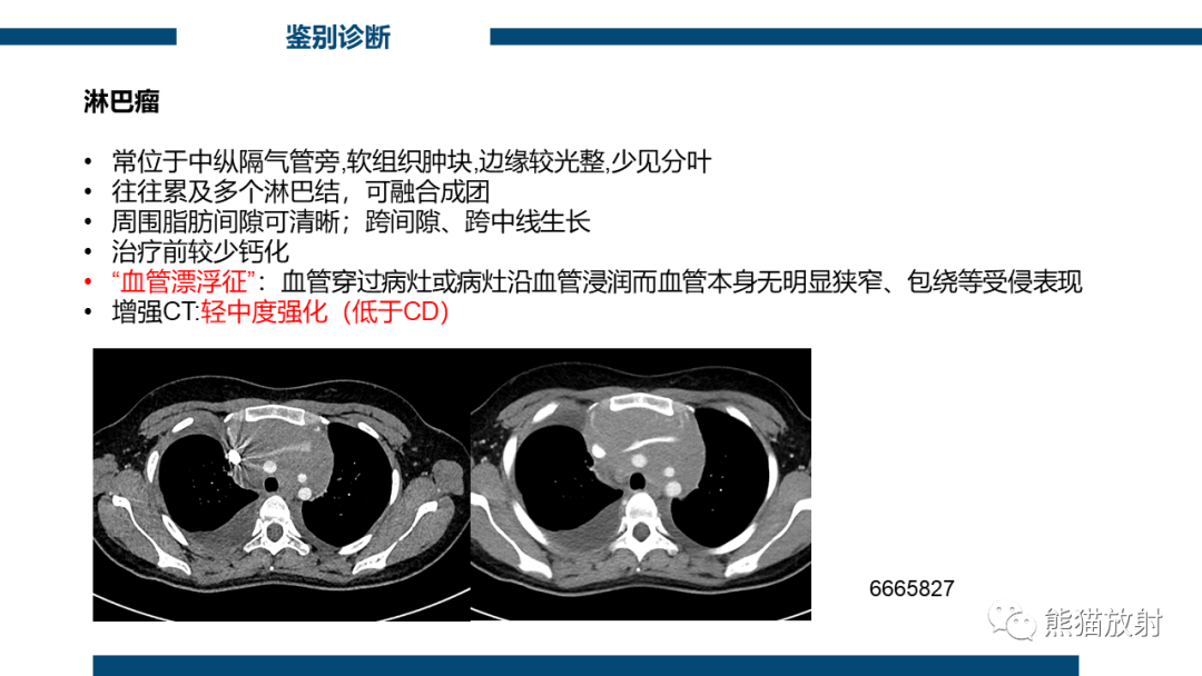 影像PPT - 【病例】纵隔Castleman病2例CT影像-28