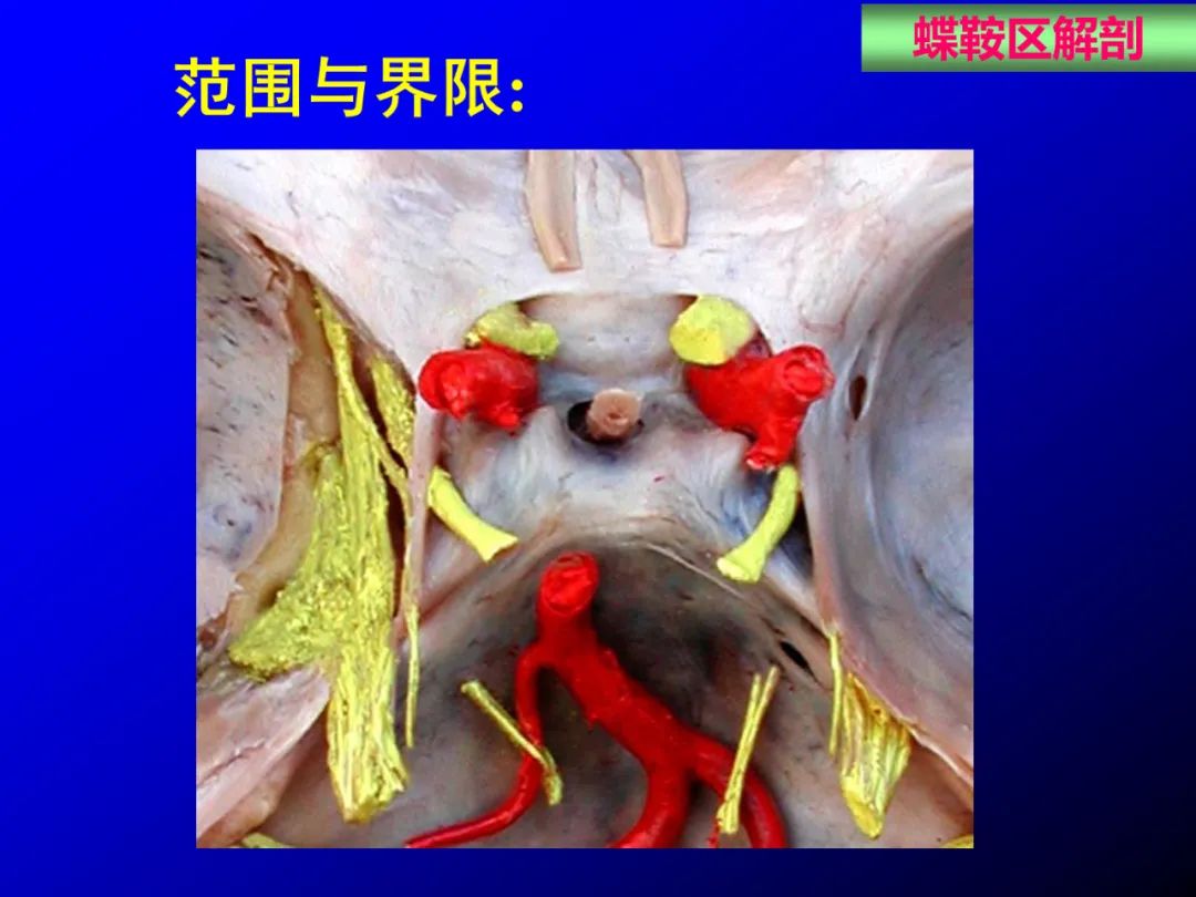 影像PPT - 【PPT】蝶鞍区断层解剖与影像对照-2