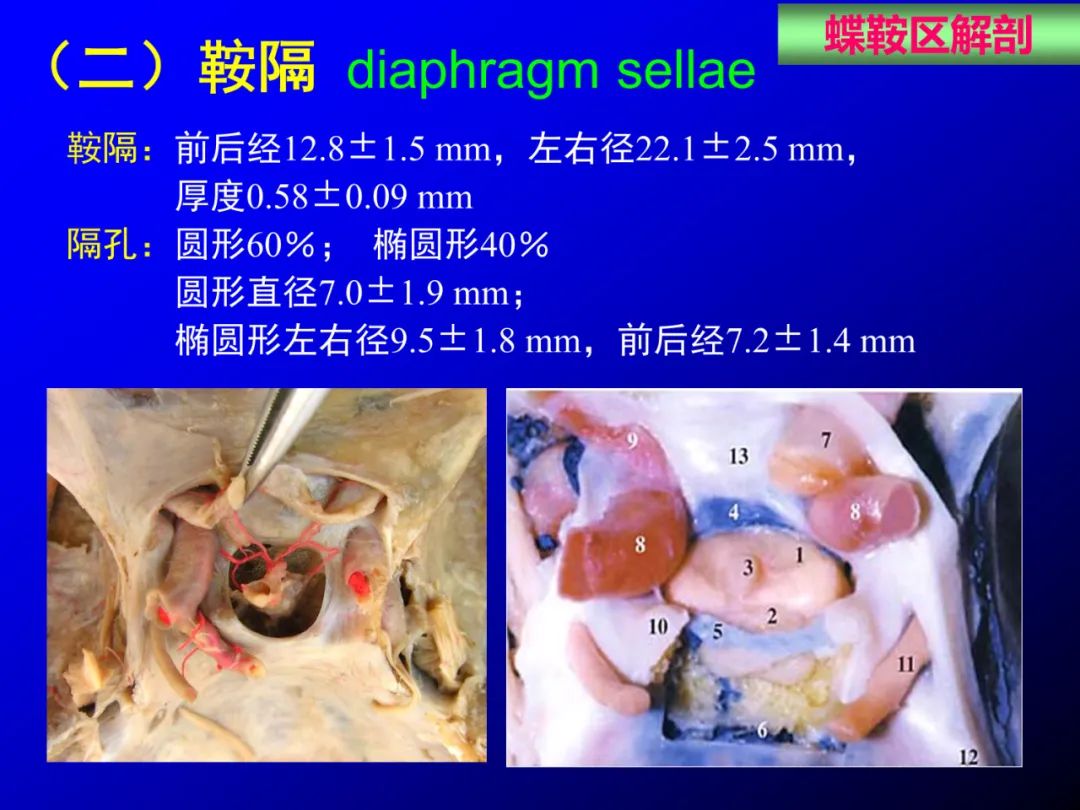 影像PPT - 【PPT】蝶鞍区断层解剖与影像对照-9