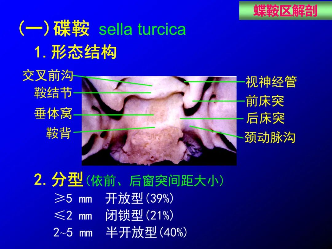 影像PPT - 【PPT】蝶鞍区断层解剖与影像对照-7