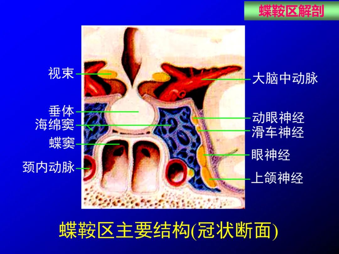影像PPT - 【PPT】蝶鞍区断层解剖与影像对照-5