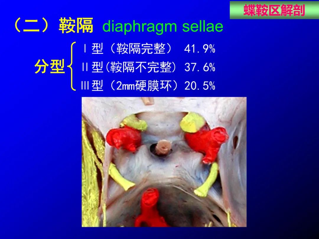 影像PPT - 【PPT】蝶鞍区断层解剖与影像对照-10