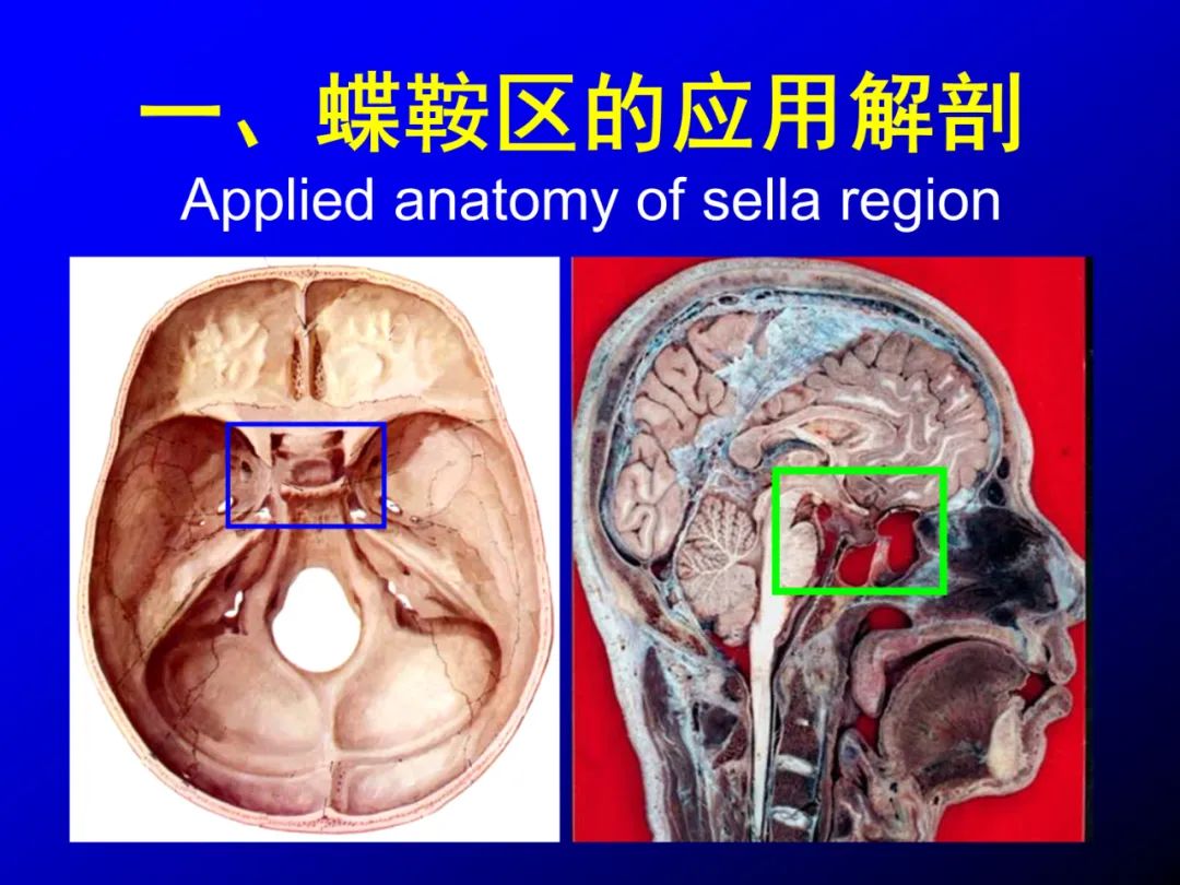 影像PPT - 【PPT】蝶鞍区断层解剖与影像对照-1