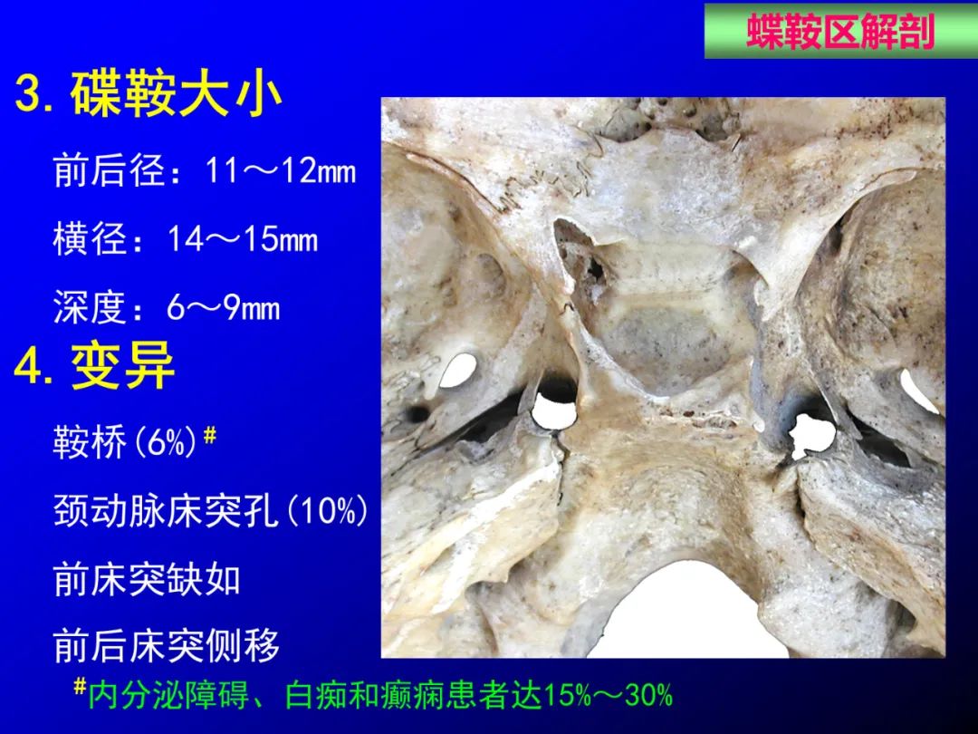 影像PPT - 【PPT】蝶鞍区断层解剖与影像对照-8