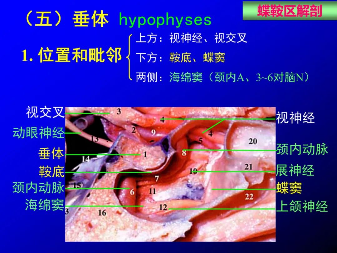 影像PPT - 【PPT】蝶鞍区断层解剖与影像对照-15