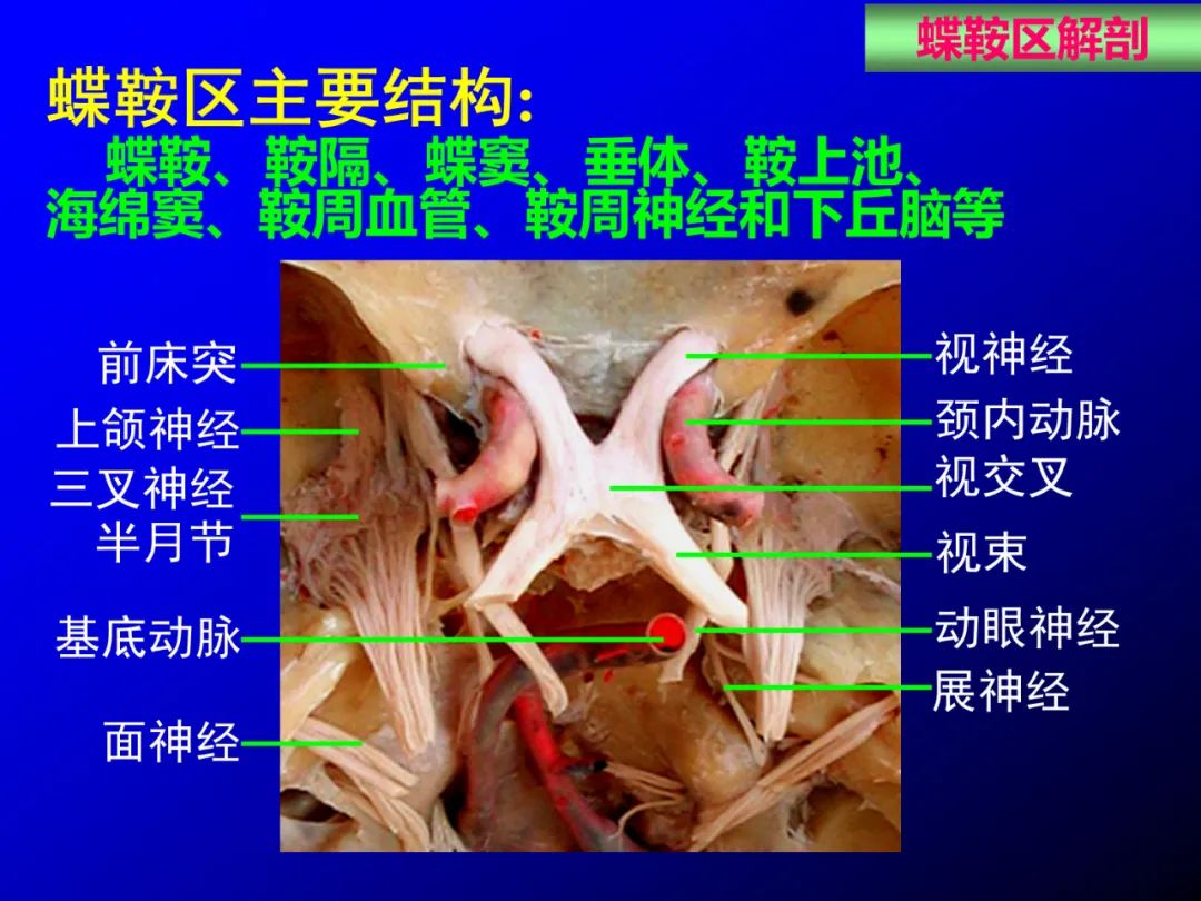 影像PPT - 【PPT】蝶鞍区断层解剖与影像对照-3