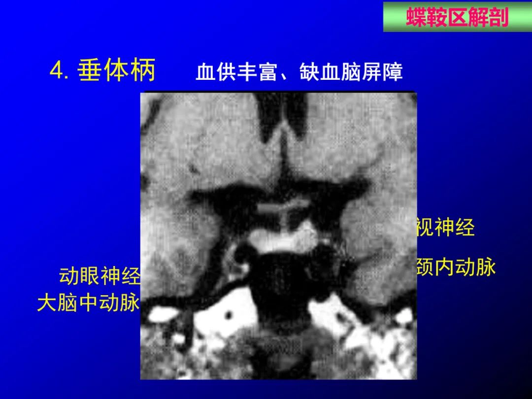 影像PPT - 【PPT】蝶鞍区断层解剖与影像对照-18