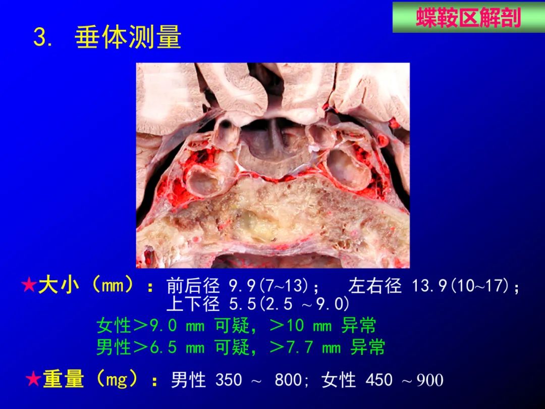 影像PPT - 【PPT】蝶鞍区断层解剖与影像对照-17