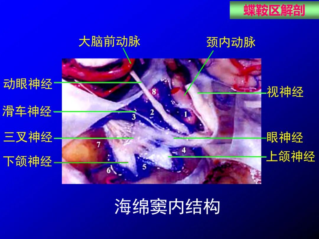 影像PPT - 【PPT】蝶鞍区断层解剖与影像对照-22