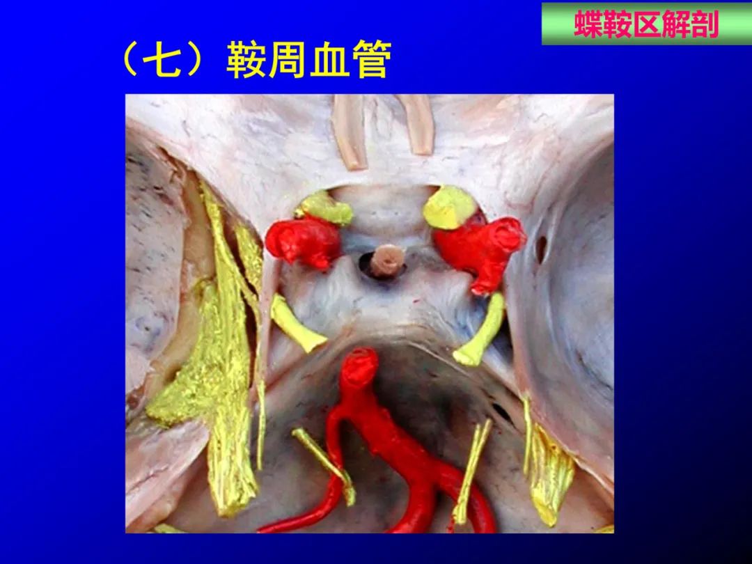影像PPT - 【PPT】蝶鞍区断层解剖与影像对照-26