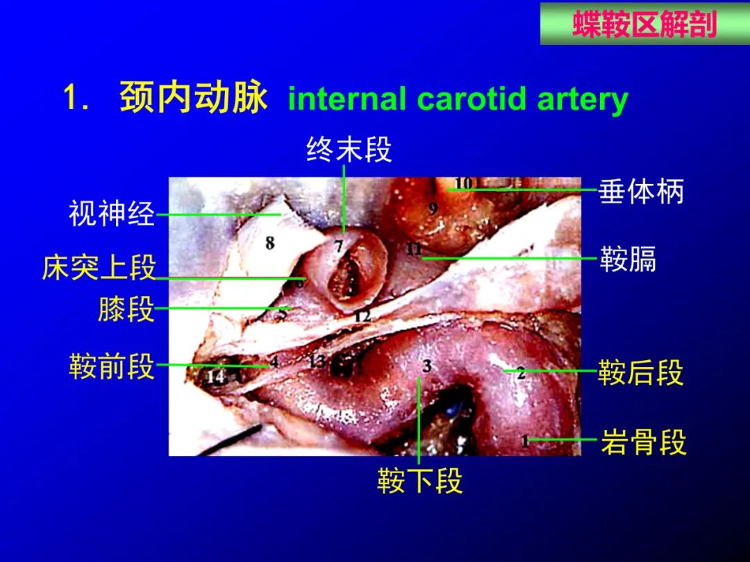 影像PPT - 【PPT】蝶鞍区断层解剖与影像对照-27