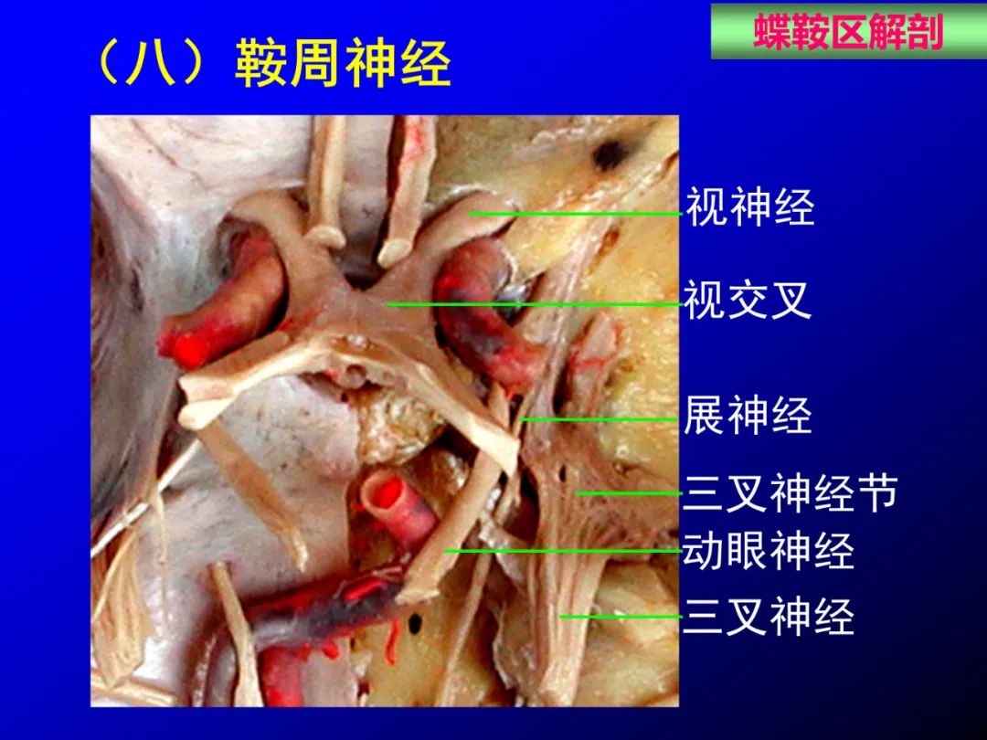 影像PPT - 【PPT】蝶鞍区断层解剖与影像对照-31
