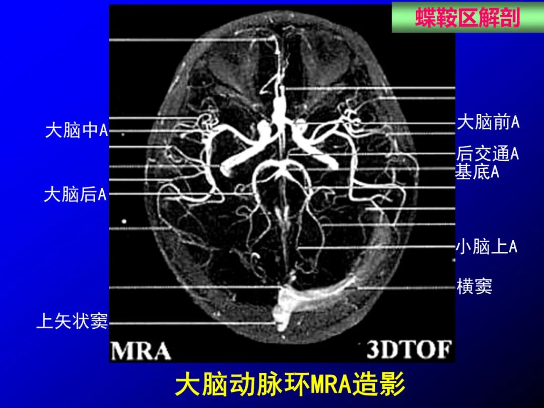 影像PPT - 【PPT】蝶鞍区断层解剖与影像对照-30