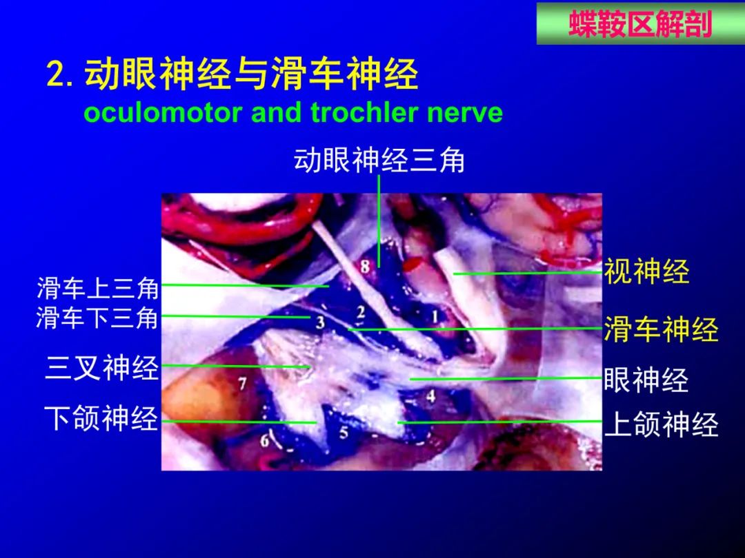 影像PPT - 【PPT】蝶鞍区断层解剖与影像对照-34