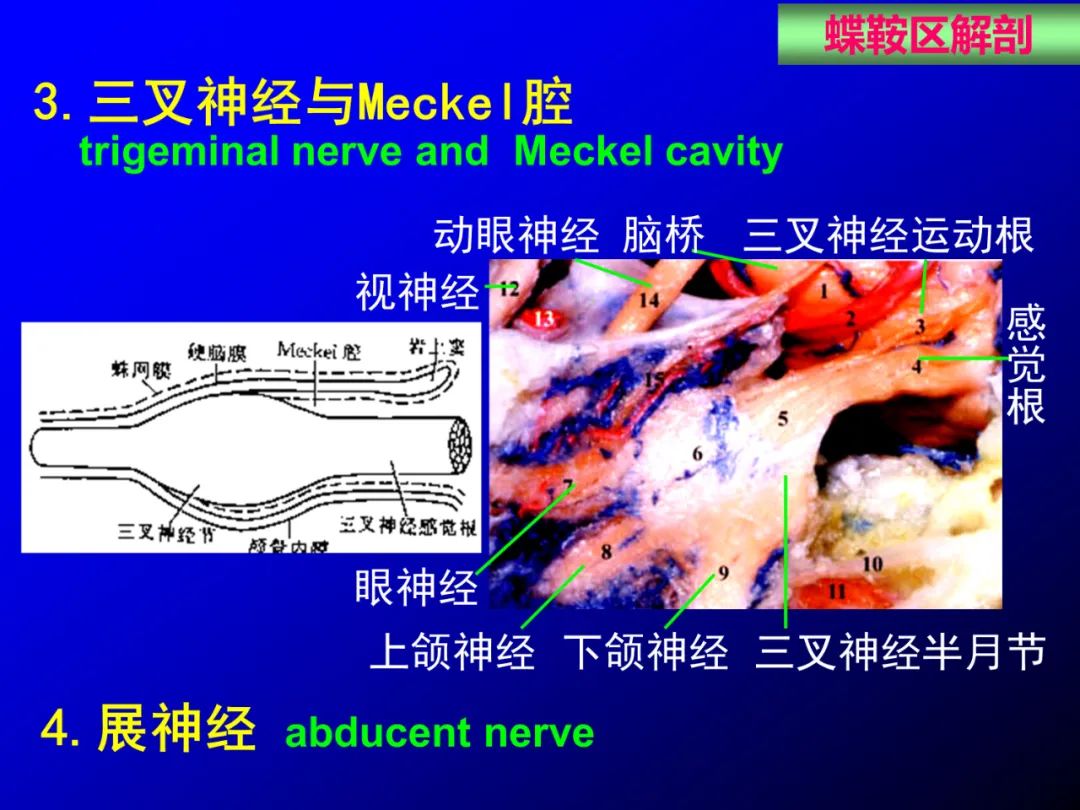 影像PPT - 【PPT】蝶鞍区断层解剖与影像对照-35