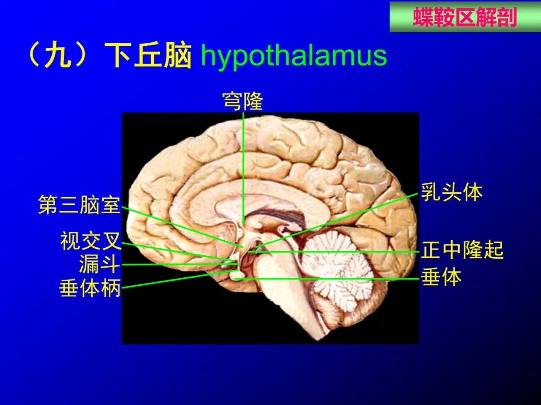 影像PPT - 【PPT】蝶鞍区断层解剖与影像对照-36