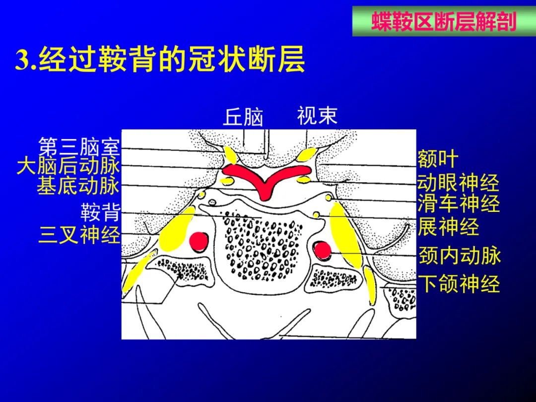 影像PPT - 【PPT】蝶鞍区断层解剖与影像对照-44