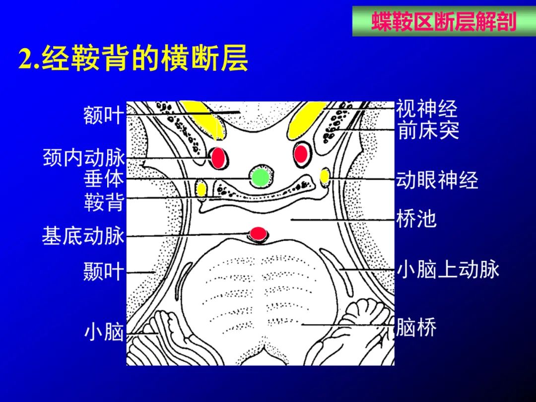 影像PPT - 【PPT】蝶鞍区断层解剖与影像对照-51