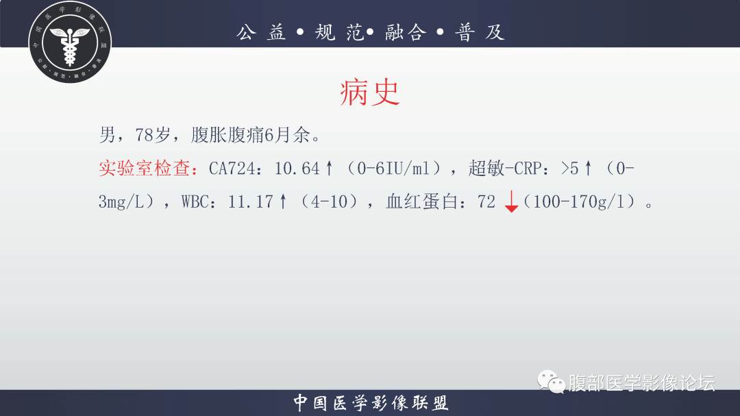 影像PPT - 【病例】结肠癌1例CT影像鉴别诊断思路-1
