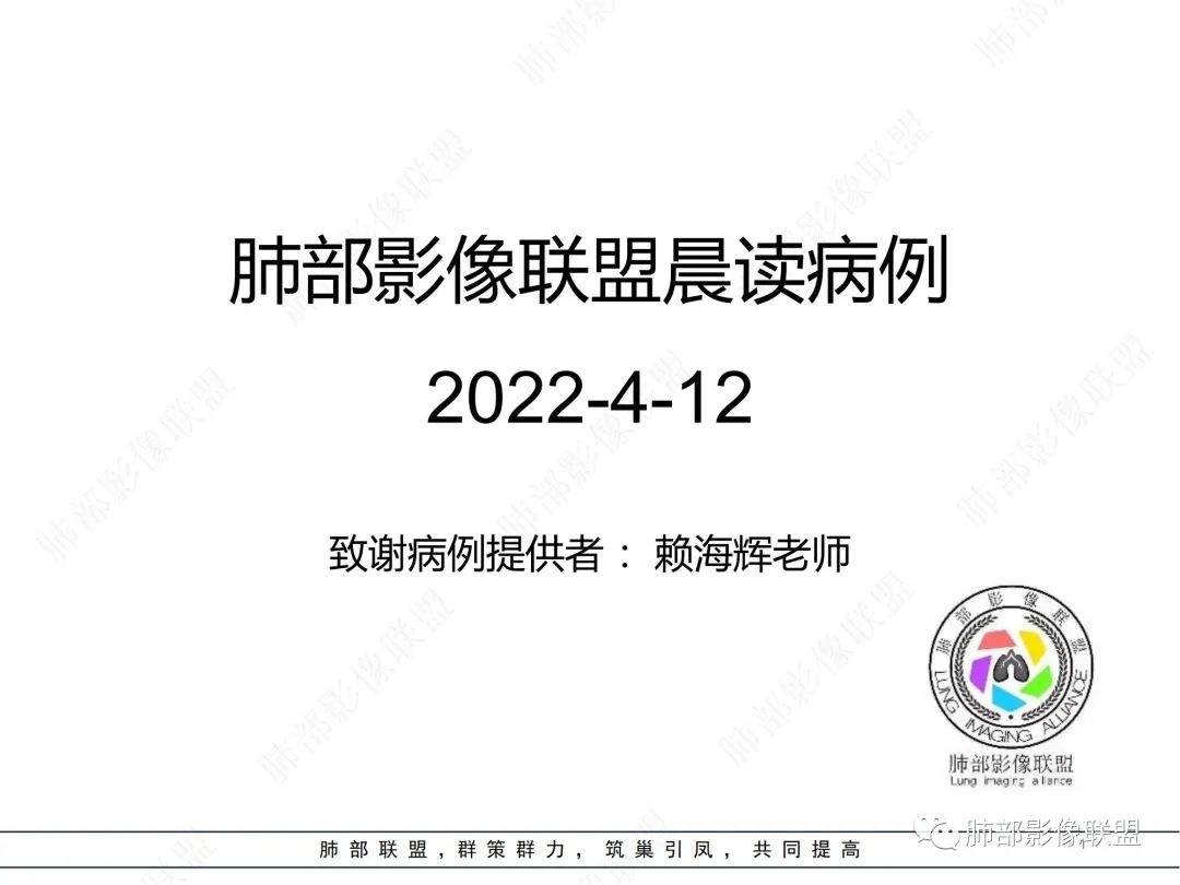 影像PPT - 【病例】纵隔占位—胸腺类癌1例CT影像-1 影像PPT - 【病例】纵隔占位—胸腺类癌1例CT影像-1