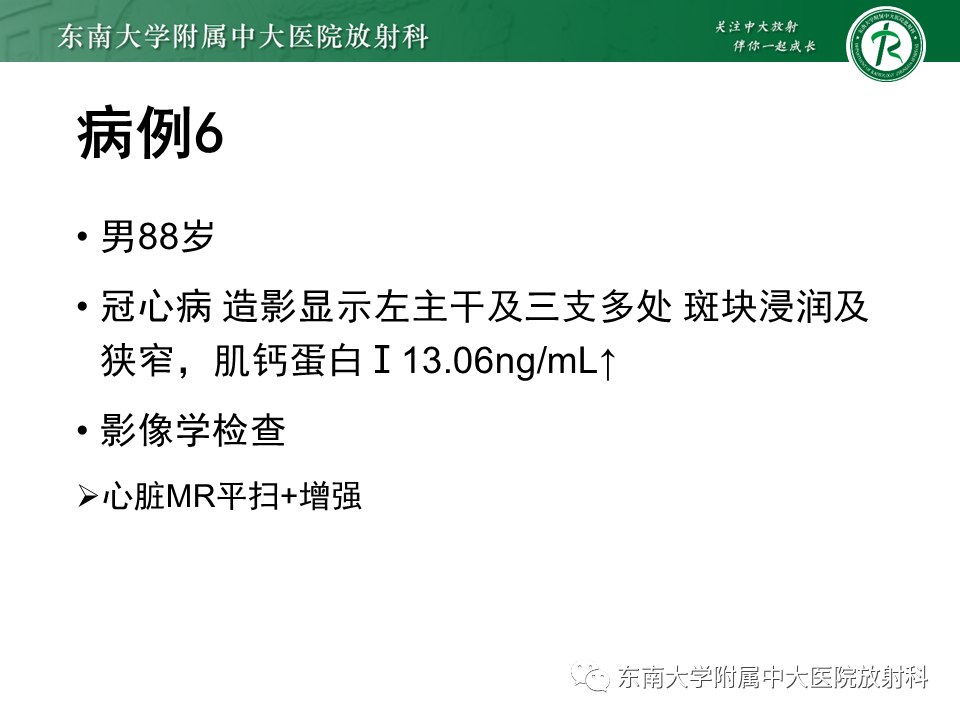 影像PPT - 【PPT】心尖局限性膨出病例-31