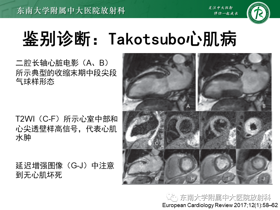影像PPT - 【PPT】心尖局限性膨出病例-39