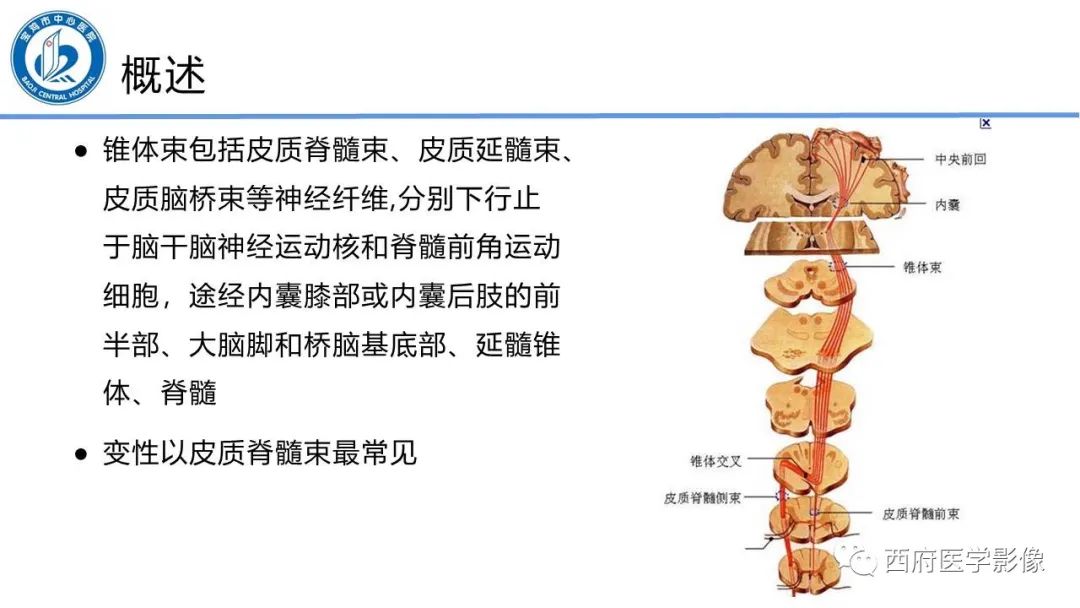 影像PPT - 【PPT】华勒氏变性的影像诊断-3