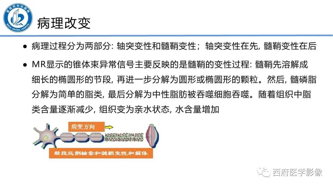 影像PPT - 【PPT】华勒氏变性的影像诊断-7