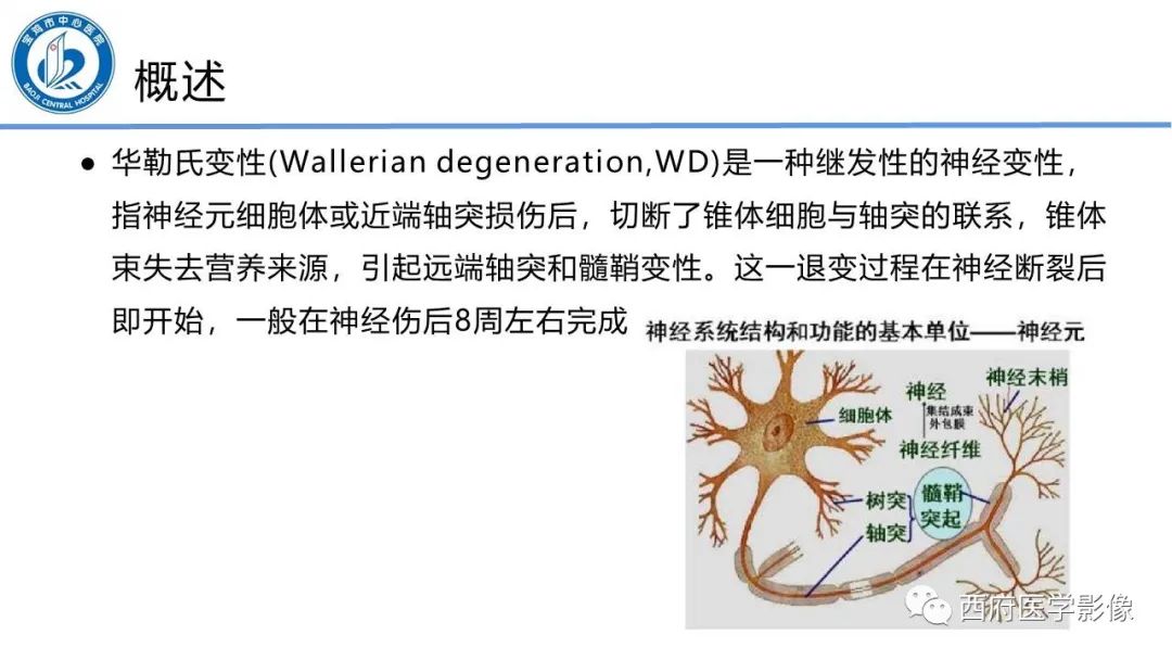 影像PPT - 【PPT】华勒氏变性的影像诊断-2
