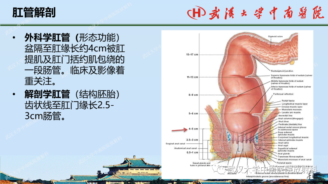 影像PPT - 【PPT】肛瘘及肛周感染病变的影像诊断-3