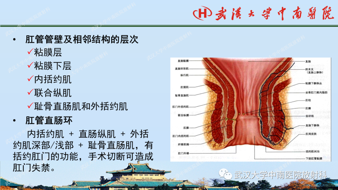 影像PPT - 【PPT】肛瘘及肛周感染病变的影像诊断-4