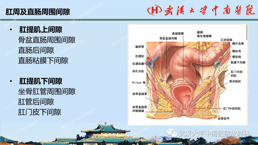 影像PPT - 【PPT】肛瘘及肛周感染病变的影像诊断-5