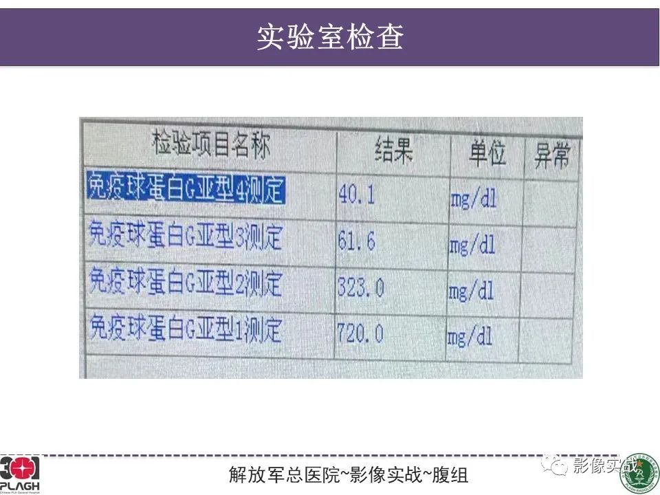 影像PPT - 【病例】胰腺实性假乳头状瘤1例CT及MR影像分析-3