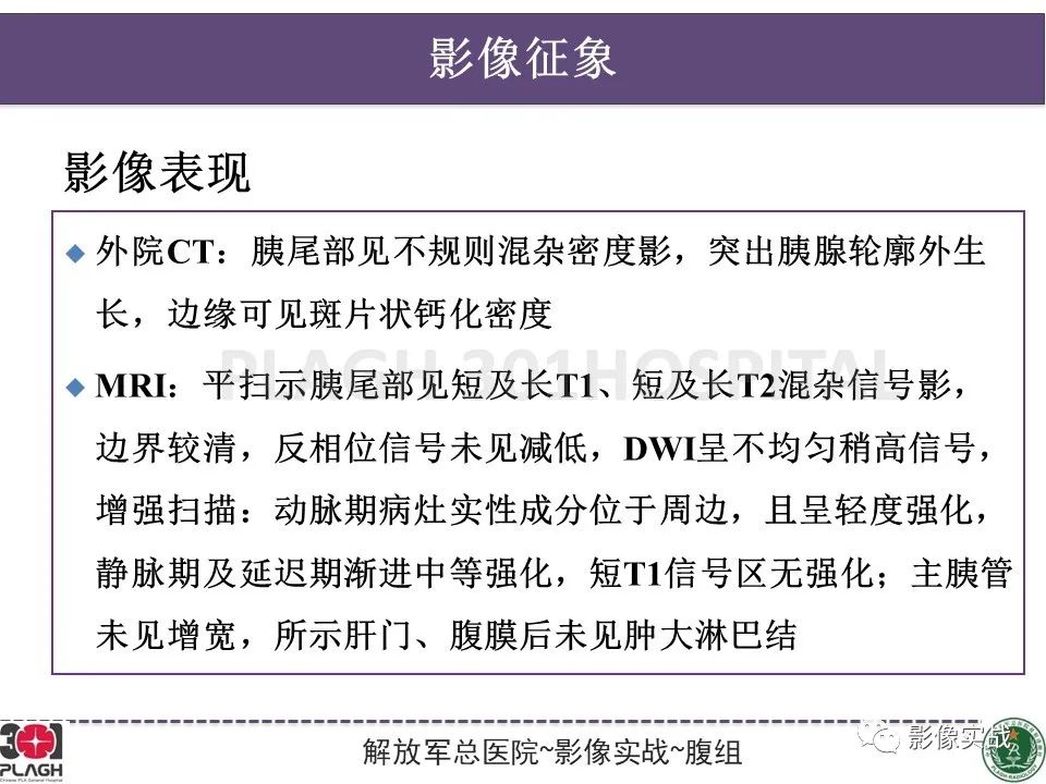 影像PPT - 【病例】胰腺实性假乳头状瘤1例CT及MR影像分析-14