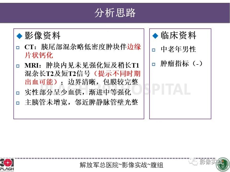 影像PPT - 【病例】胰腺实性假乳头状瘤1例CT及MR影像分析-15
