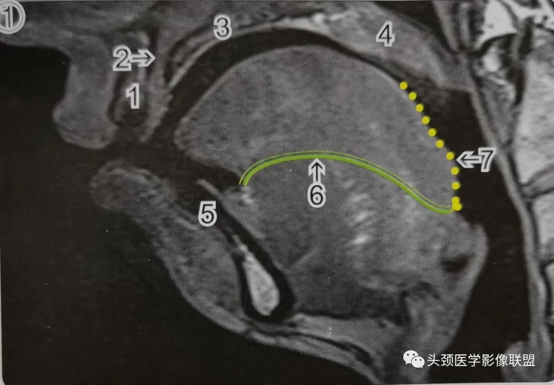 影像PPT - 固有口腔影像解剖-1 影像PPT - 固有口腔影像解剖-1
