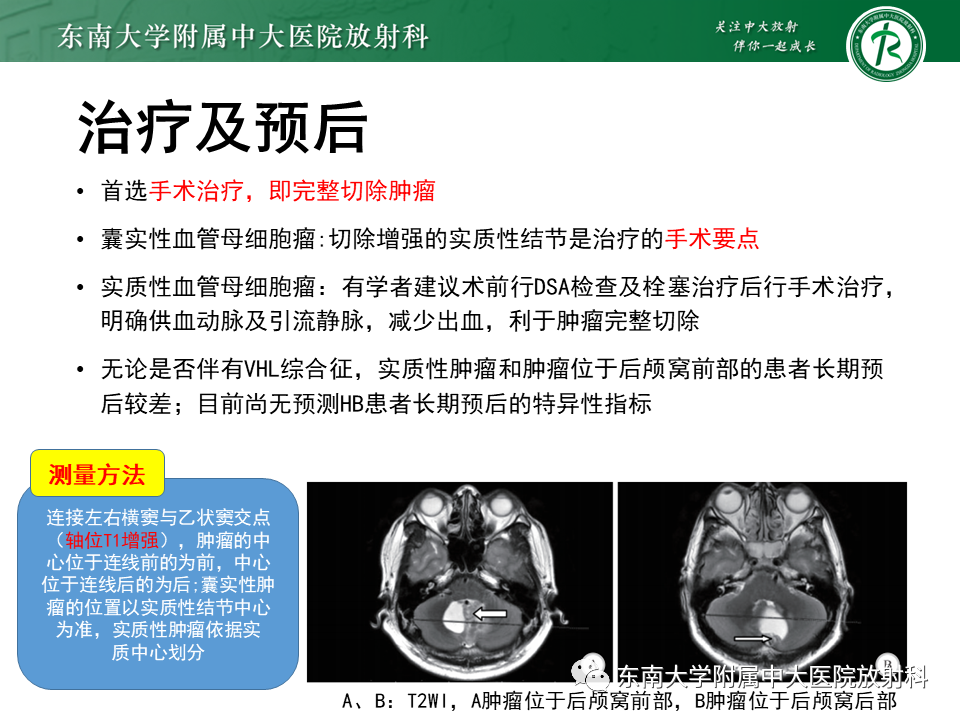 影像PPT - 【PPT】小脑血管母细胞瘤-34