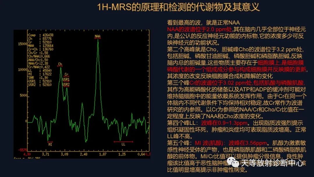 影像PPT - 【病例】颅内占位性病变1例波谱分析-25 影像PPT - 【病例】颅内占位性病变1例波谱分析-25