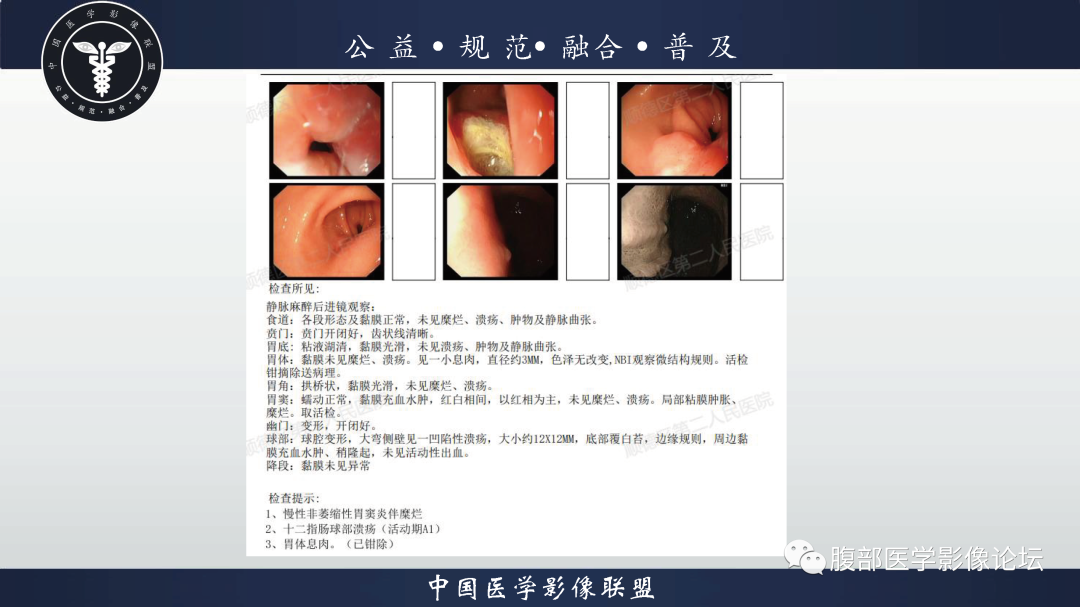 影像PPT - 【病例】胃窦神经内分泌肿瘤1例CT及MR影像-10