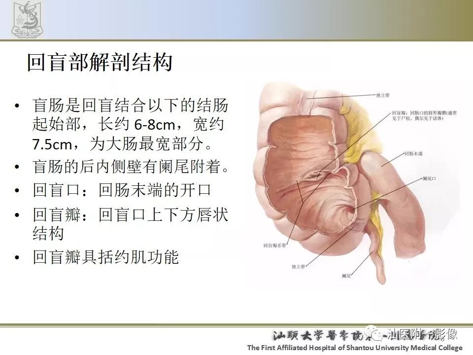 影像PPT - 【PPT】肠套叠影像学诊断-6