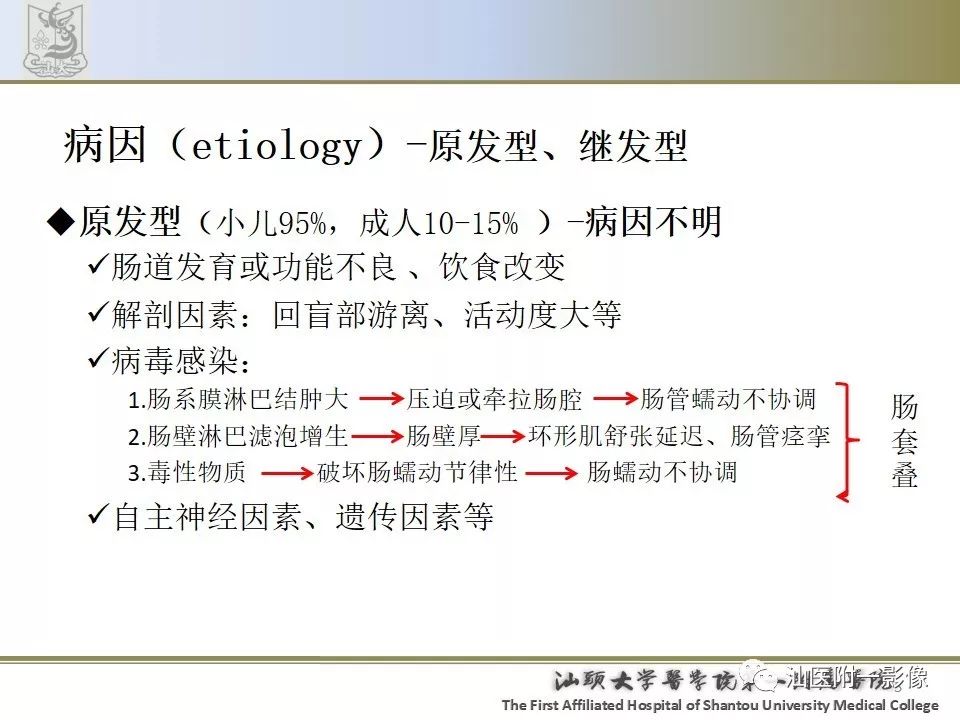 影像PPT - 【PPT】肠套叠影像学诊断-5