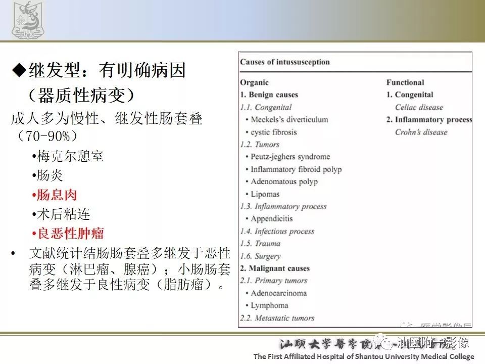 影像PPT - 【PPT】肠套叠影像学诊断-8