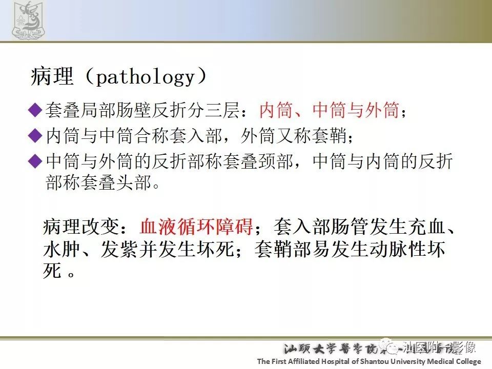 影像PPT - 【PPT】肠套叠影像学诊断-12